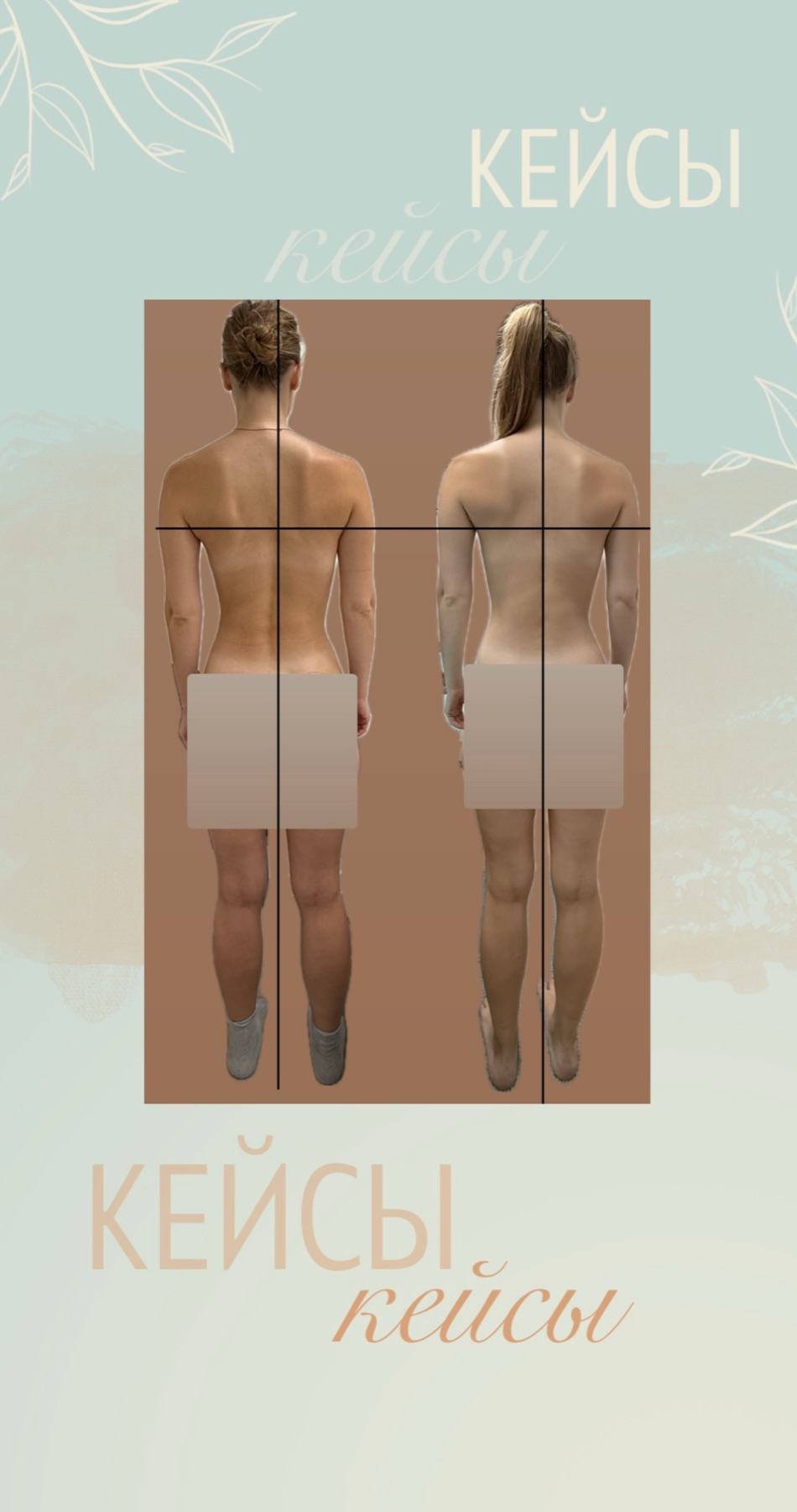 Сравнительные фотографии осанки клиентки до и после приёма